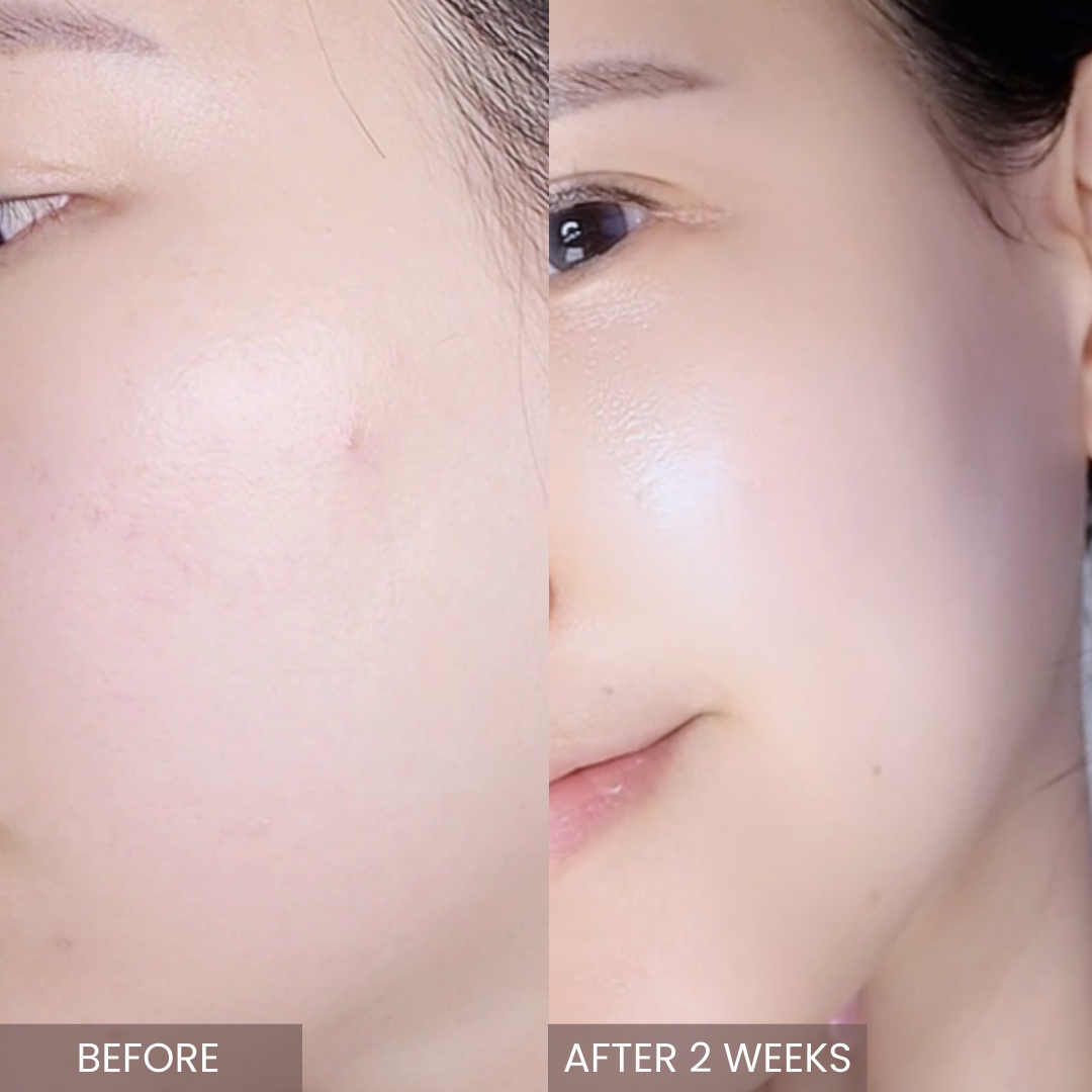 Pink Tea Tree Toner